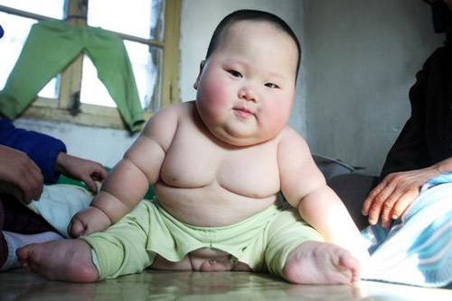 Obese Asian Baby 117